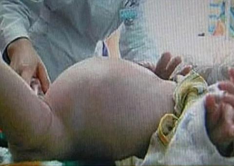 Mãe descobre que menino de dois anos está "grávido"